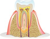 Do You Need a Root Canal Treatment?