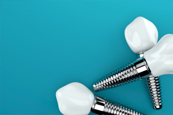 dental implants